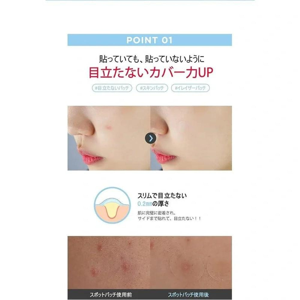 G9SKIN 零解決方案點覆蓋補丁(1 件 x 36 件)/ 零解決方案點覆蓋補丁(36 件)