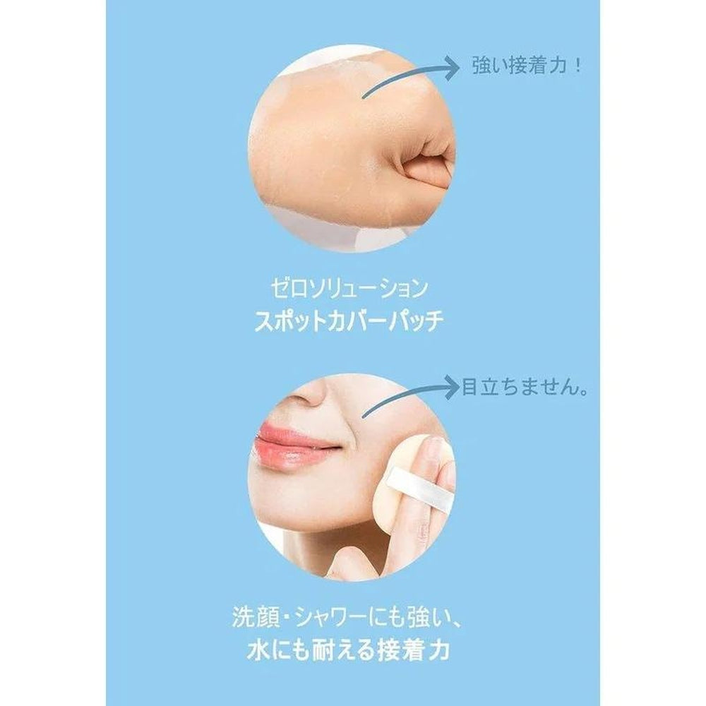 G9SKIN 零解決方案點覆蓋補丁(1 件 x 36 件)/ 零解決方案點覆蓋補丁(36 件)