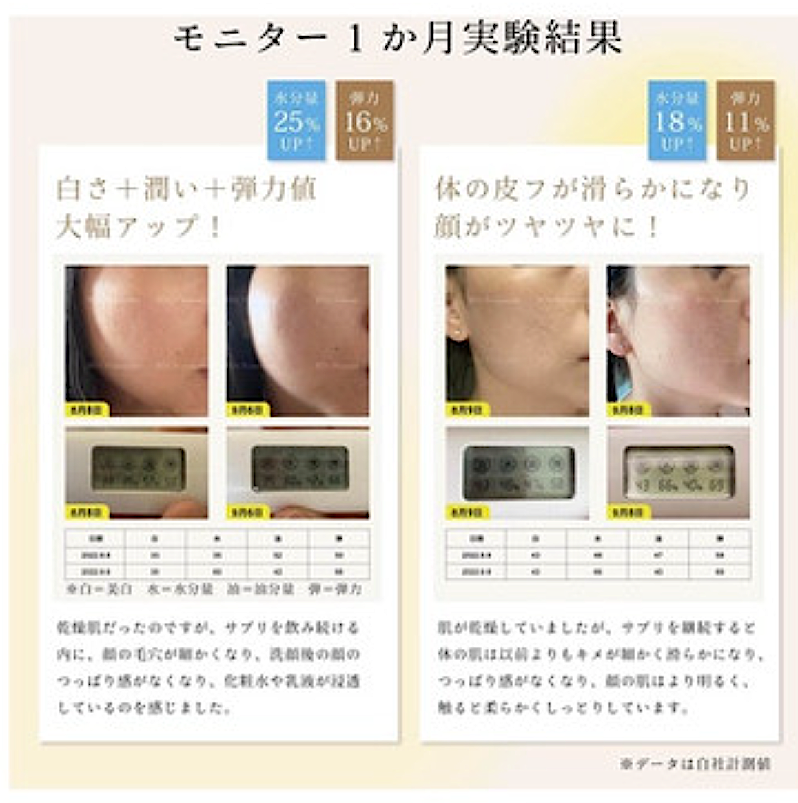 [Dr.Watanabe] Nomumin Ceramide 1,050mg NMN 3,000mg 60 tablets 1 month supply Supervised by a medical doctor Domestic production Highly moisturizing Folic acid Vitamin B supplement Soft capsule Pineapple ceramide