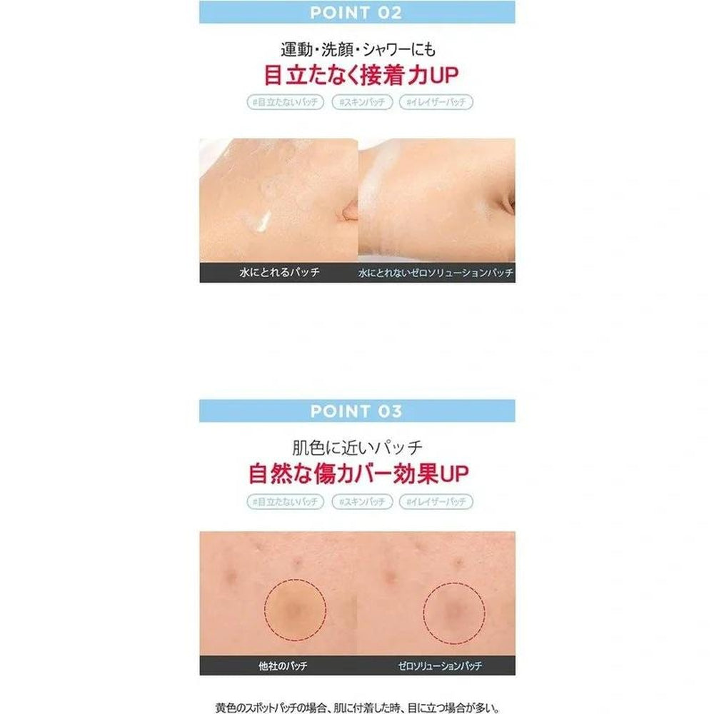 G9SKIN 零解決方案點覆蓋補丁（1 件 x 36 件）/ 零解決方案點覆蓋補丁（36 件）